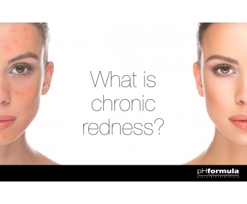 What is chronic redness, or rosacea?