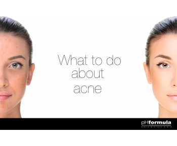 What to do about acne?